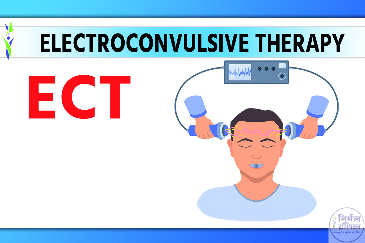 Electroconvulsive Therapy(ECT)